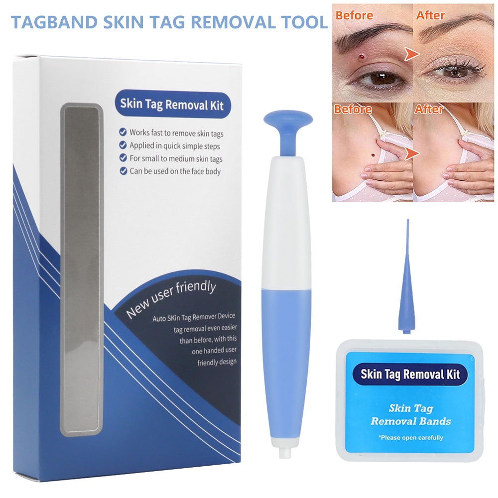 Kit de suppression de grains de beauté à usage domestique, dissolvant de verrues, outil de traitement des acrochordons par micro-bande, outil de soin de la peau facile à nettoyer