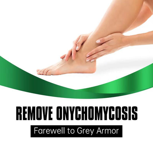 Tratamiento para Hongos de Uñas Cuidado de Pies Gel Removedor de Hongos de Uñas de Pies y Manos Antinfección Paroniquia Onicomicosis