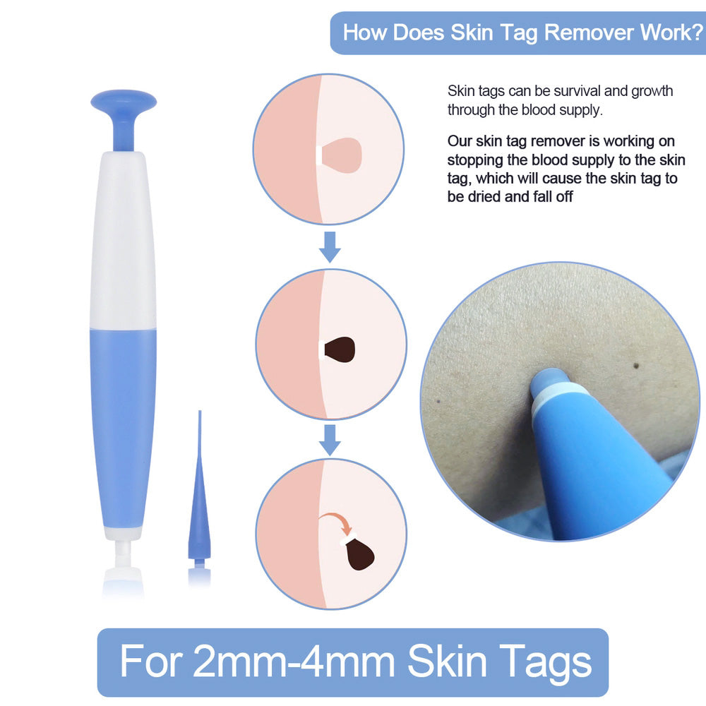 Kit de suppression de grains de beauté à usage domestique, dissolvant de verrues, outil de traitement des acrochordons par micro-bande, outil de soin de la peau facile à nettoyer