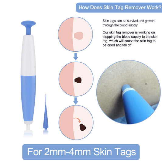 Kit de suppression de grains de beauté à usage domestique, dissolvant de verrues, outil de traitement des acrochordons par micro-bande, outil de soin de la peau facile à nettoyer